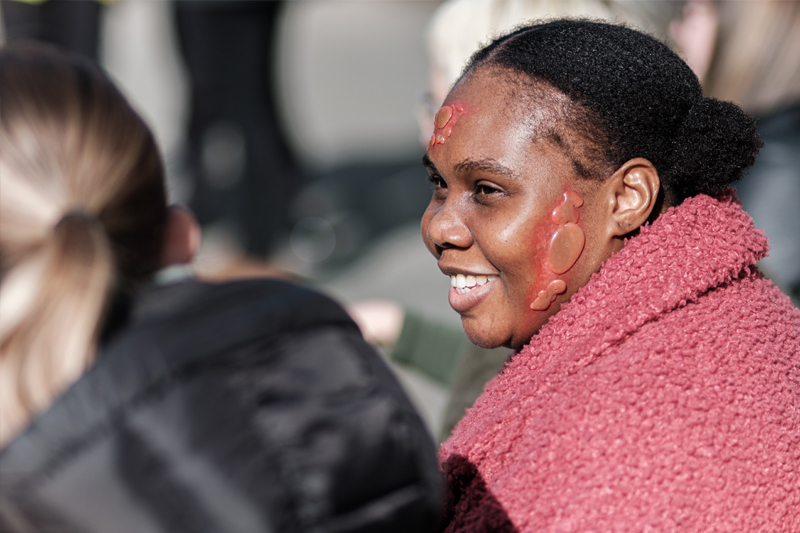 Student with fake injury makeup